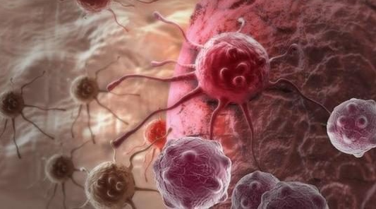 文献解读|Nat Cancer（22.7）：侵袭性导管癌和小叶乳腺癌的免疫景观揭