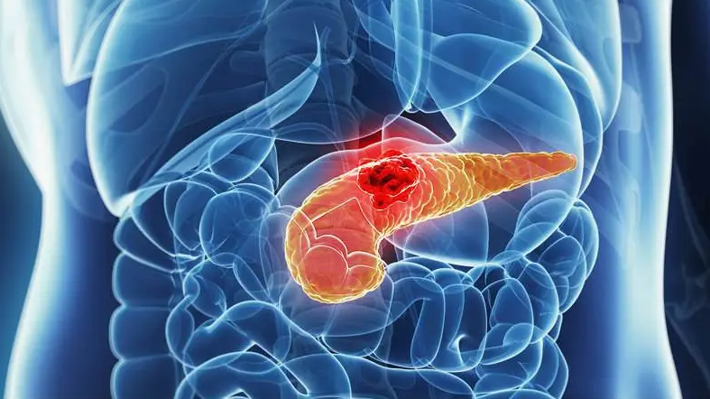 文献解读|Cell Reports Medicine（14.3）：胆汁酸代谢组学