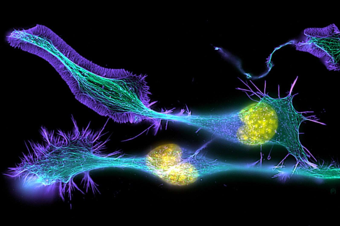 文献解读|Immunity（32.4）：人类小胶质细胞的成熟由特定的基因调控网络