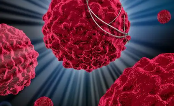 文献解读|Cancer Discov（29.7）：追踪从原发性 ccRCC 到转