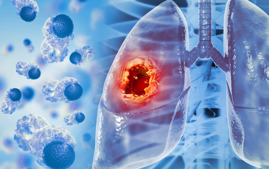 文献解读|Nat Commun（14.3）：蛋白质组学分析揭示预测染色体不稳定性