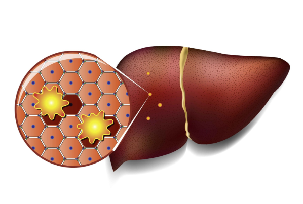文献解读|Nature（48.5）：母体肥胖导致库普弗细胞编程引发脂肪肝