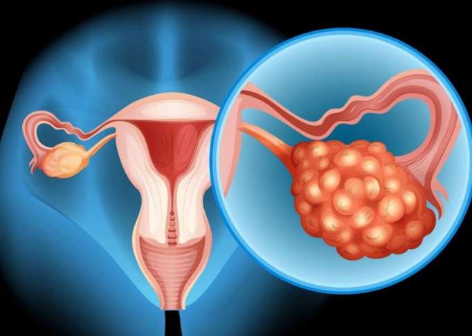 文献解读|Nat Med（50）：多囊卵巢综合征患者子宫内膜的单细胞分析