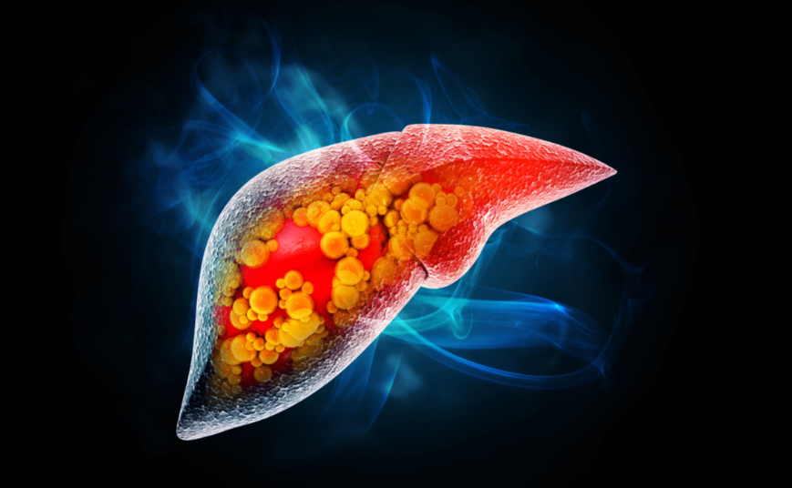 文献解读|J Hepatol（33）：人类肝星状细胞的多模态分析确定了代谢功能障