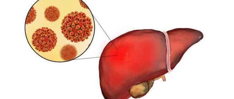 文献解读|J FUNCT FOODS（5.223）：肝脂质组学和蛋白质组学分析揭